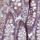 Immunohistochemical staining of human colon using Anti-PSMB8 antibody HPA050327.