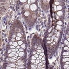 Immunohistochemical staining of human colon using Anti-PSMB8 antibody HPA050327.