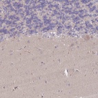 Anti-MRPS18B Antibody