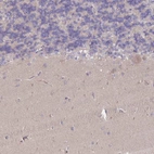 Anti-MRPS18B Antibody