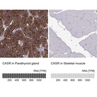 Anti-CASR Antibody