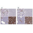 Anti-CASR Antibody