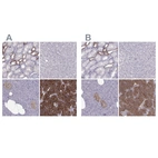 Immunohistochemical staining of human kidney, liver, pancreas and parathyroid gland using Anti-CASR antibody HPA050335 (A) shows similar protein distribution across tissues to independent antibody HPA039686 (B).