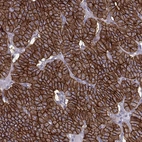 Immunohistochemical staining of human parathyroid gland shows strong membranous positivity in glandular cells.