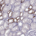 Anti-CASR Antibody