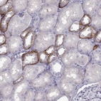 Immunohistochemical staining of human kidney shows moderate membranous positivity in cells in distal tubules.