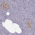 Anti-CASR Antibody