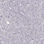 Anti-CASR Antibody