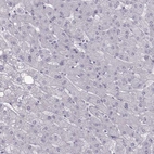 Immunohistochemical staining of human liver shows no positivity in hepatocytes as expected.