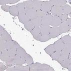 Immunohistochemical staining of human skeletal muscle shows no positivity in myocytes as expected.
