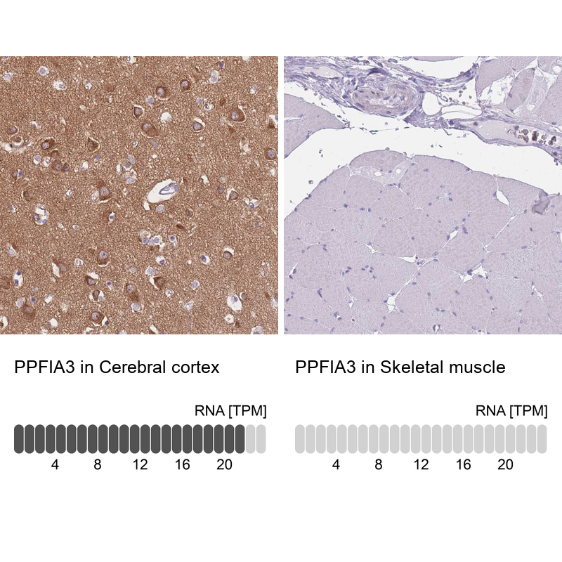 Anti-PPFIA3 Antibody