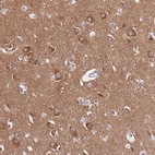 Immunohistochemical staining of human cerebral cortex shows high expression.
