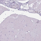 Immunohistochemical staining of human skeletal muscle shows low expression as expected.