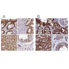 Anti-UQCRFS1 Antibody