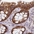 Immunohistochemical staining of human colon using Anti-UQCRFS1 antibody HPA050339.