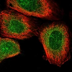 Immunofluorescent staining of human cell line A-431 shows localization to nuclear membrane.