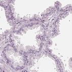 Immunohistochemical staining of human prostate shows no positivity in glandular cells as expected.