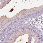 Immunohistochemical staining of human epididymis shows moderate cytoplasmic positivity in glandular cells.