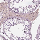Immunohistochemical staining of human testis shows moderate cytoplasmic positivity in Leydig cells.