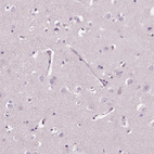 Immunohistochemical staining of human cerebral cortex shows no positivity in neurons as expected.
