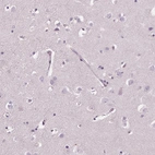Immunohistochemical staining of human cerebral cortex shows no positivity in neurons as expected.