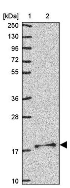 Lane 1: Marker [kDa] 250, 130, 95, 72, 55, 36, 28, 17, 10_br/_Lane 2: Human cell line RT-4