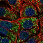 Immunofluorescent staining of human cell line MCF7 shows localization to mitochondria.