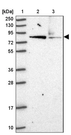 Lane 1: Marker [kDa] 250, 130, 95, 72, 55, 36, 28, 17, 10_br/_Lane 2: Human cell line RT-4_br/_Lane 3: Human cell line U-251MG sp