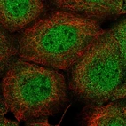 Anti-PIK3C2B Antibody