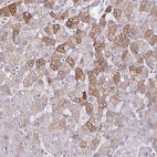 Anti-LDLRAP1 Antibody