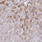Anti-LDLRAP1 Antibody