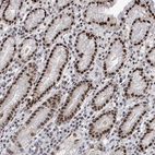 Anti-ERCC5 Antibody
