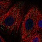 Anti-SLC11A1 Antibody