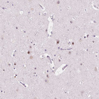 Anti-NOLC1 Antibody