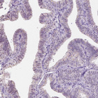 Anti-NOLC1 Antibody