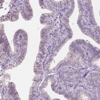 Immunohistochemical staining of human fallopian tube shows moderate positivity in nucleoli in glandular cells.
