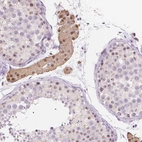 Immunohistochemical staining of human testis shows moderate positivity in nucleoli and cytoplasm in Leydig cells and positivity in Sertoli cells.