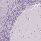 Anti-NOLC1 Antibody