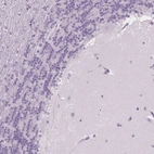 Immunohistochemical staining of human cerebellum shows weak positivity in nucleoli in molecular layer.