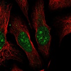 Anti-ESF1 Antibody