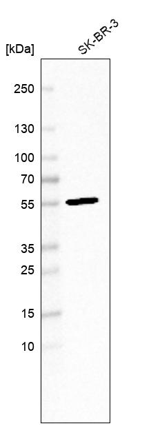 Anti-FBXL20 Antibody