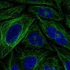Immunofluorescent staining of human cell line SiHa shows localization to microtubules.