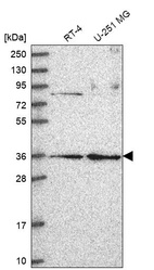Western blot analysis in human cell line RT-4 and human cell line U-251 MG.