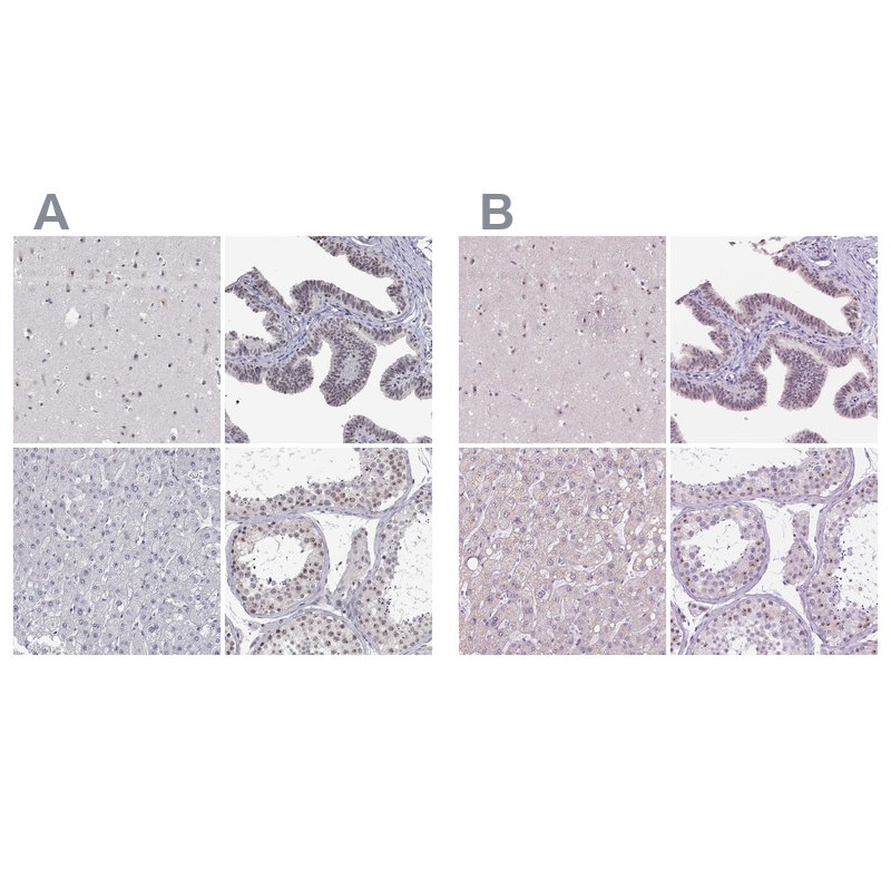 Anti-NHP2 Antibody