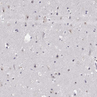 Immunohistochemical staining of human cerebral cortex shows moderate nucleoli positivity in neurons.