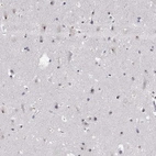 Immunohistochemical staining of human cerebral cortex shows moderate nucleoli positivity in neurons.