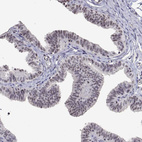 Immunohistochemical staining of human fallopian tube shows moderate nucleoli positivity in glandular cells.