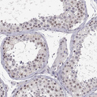 Immunohistochemical staining of human testis shows moderate nucleoli positivity in cells in seminiferous ducts.