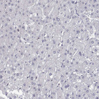 Immunohistochemical staining of human liver shows no positivity in hepatocytes as expected.