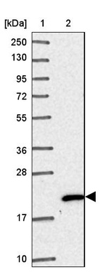 Lane 1: Marker [kDa] 250, 130, 95, 72, 55, 36, 28, 17, 10_br/_Lane 2: Human cell line RT-4